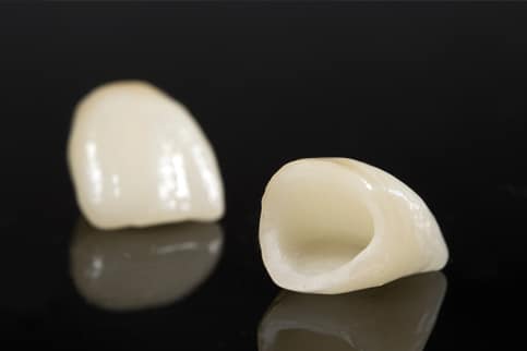 Crowns & Bridges - image of dental crowns