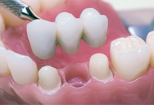 Hands holding green eco-friendly dental symbol representing sustainable dentistry in North York