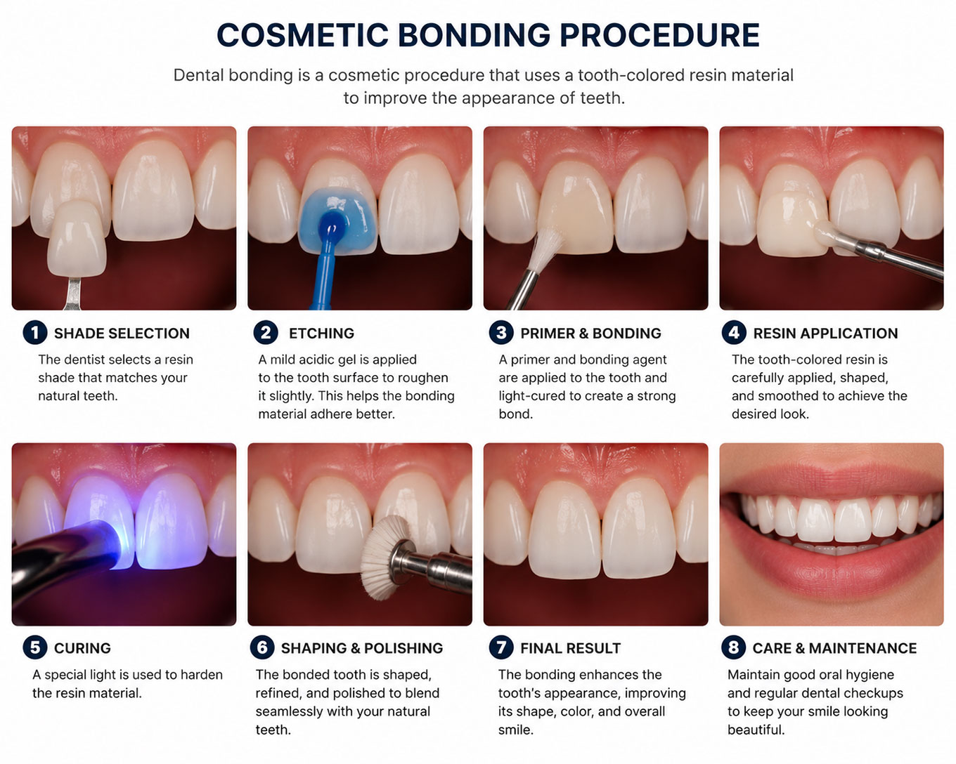 Cosmetic Bonding Procedure