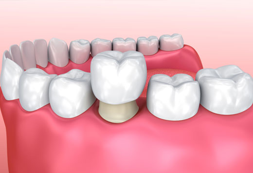 Hands holding green eco-friendly dental symbol representing sustainable dentistry in North York