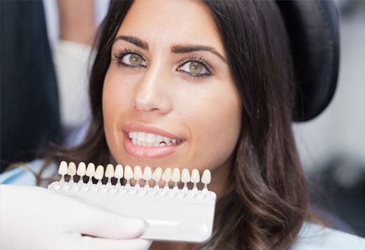 Porcelain Veneers