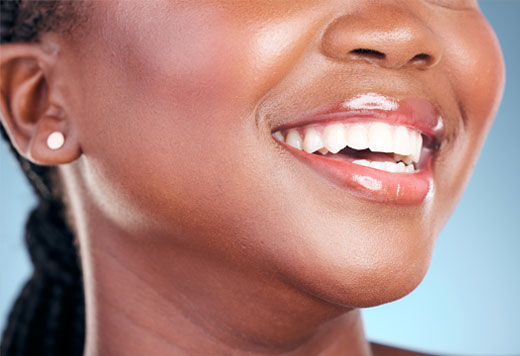Teeth Whitening