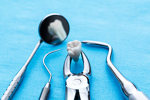 Tooth Extraction Tools
